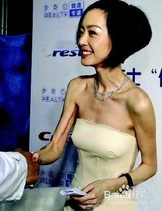 娱乐圈减肥成功的女星